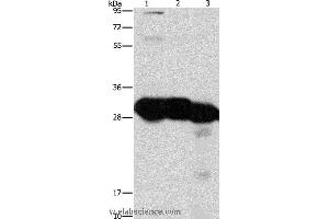 Western blot analysis of Mouse liver and kidney tissue, human fetal liver tissue, using KHK Polyclonal Antibody at dilution of 1:1350 (Ketohexokinase antibody)