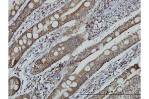 Immunoperoxidase of monoclonal antibody to MRRF on formalin-fixed paraffin-embedded human small Intestine. (MRRF antibody  (AA 163-262))