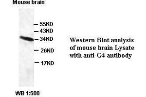 Image no. 1 for anti-Chromosome 6 Open Reading Frame 47 (C6ORF47) antibody (ABIN791190) (C6orf47 antibody)