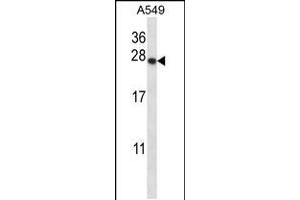 Western blot analysis in A549 cell line lysates (35ug/lane). (PSMD9 antibody  (C-Term))