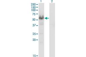 Western Blot analysis of PPP3CA expression in transfected 293T cell line by PPP3CA monoclonal antibody (M03), clone 2G8. (PPP3CA antibody  (AA 1-84))