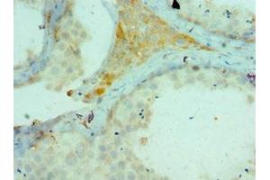 Immunohistochemistry of paraffin-embedded human testis tissue using ABIN7172781 at dilution of 1:100 (CTCFL antibody  (AA 1-270))