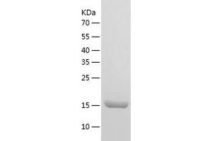 Western Blotting (WB) image for Coatomer Protein Complex, Subunit zeta 1 (COPZ1) (AA 1-177) protein (His tag) (ABIN7286663) (COPZ1 Protein (AA 1-177) (His tag))