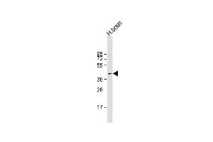 Anti-PRKACB Antibody (K29) at 1:1000 dilution + human brain lysate Lysates/proteins at 20 μg per lane. (PRKACB antibody  (N-Term))