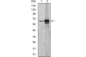 Western blot analysis using FYN mouse mAb against NIH/3T3 (1) and Hela (2) cell lysate. (FYN antibody)