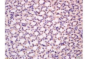 Formalin-fixed and paraffin embedded rat stomach tissue labeled with Anti-BK channel Polyclonal Antibody, Unconjugated 1:300 followed by conjugation to the secondary antibody and DAB staining. (KCNMA1 antibody  (AA 1131-1236))