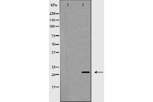 Western blot analysis of Claudin 4 expression in HeLa cells.