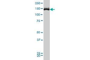 Viral Entry Inhibition (VEI) image for anti-Tripartite Motif Containing 33 (TRIM33) (AA 1006-1106) antibody (ABIN599250) (TRIM33 antibody  (AA 1006-1106))