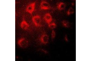 Immunofluorescent analysis of Wilms Tumor 1 staining in MCF7 cells.