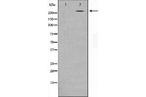 Western blot analysis on MDA-MB-435 cell lysate using NCoR1 Antibody,The lane on the left is treated with the antigen-specific peptide. (NCOR1 antibody  (N-Term))