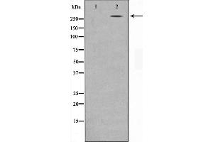 Western blot analysis on MDA-MB-435 cell lysate using NCoR1 Antibody,The lane on the left is treated with the antigen-specific peptide. (NCOR1 antibody  (N-Term))