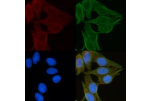 ABIN6260054 and ABIN6272249 staining Hela cells(30 min of UV treatment) by IF/ICC. (ARRDC1 antibody  (C-Term))