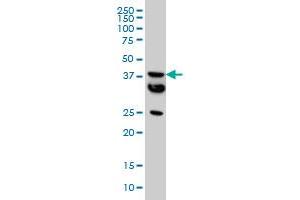 MT monoclonal antibody (M01), clone 2F2 Western Blot analysis of MT expression in HeLa . (MCAT antibody  (AA 291-390))