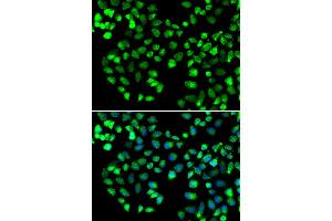Immunofluorescence analysis of MCF-7 cells using GRM4 antibody (ABIN5974386). (Metabotropic Glutamate Receptor 4 antibody)