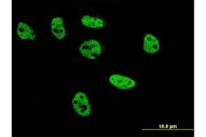 Immunofluorescence of monoclonal antibody to TFAP2B on HeLa cell. (TFAP2B antibody  (AA 73-182))