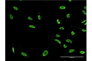 Immunofluorescence of monoclonal antibody to PKN1 on HeLa cell.