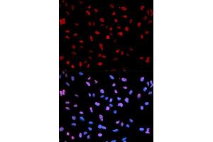 Immunofluorescence analysis of U2OS cells using Phospho-MEF2C-S396 antibody (ABIN5969920). (MEF2C antibody  (pSer396))