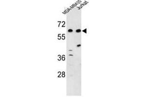 Western blot analysis of C19orf26 Antibody (Center) in MDA-MB435, Jurkat cell line lysates (35µg/lane). (C19orf26 antibody  (Middle Region))