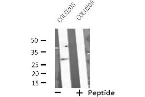Western blot analysis of extracts from COLO205 cells, using MSX2 antibody. (Msx2/Hox8 antibody  (Internal Region))