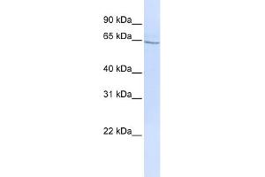 WB Suggested Anti-GLP2R Antibody Titration: 0. (GLP2R antibody  (N-Term))