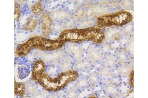 Immunohistochemistry of paraffin-embedded mouse kidney using LYZ antibody. (LYZ antibody)