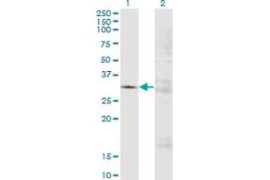 Western Blot analysis of FCN3 expression in transfected 293T cell line by FCN3 monoclonal antibody (M01A), clone 4B4.