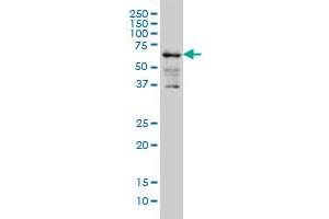 IMP-3 monoclonal antibody (M01A), clone 3B12 Western Blot analysis of IMP-3 expression in K-562 . (IGF2BP3 antibody  (AA 1-579))