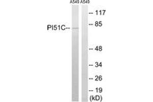 Western blot analysis of extracts from A549 cells, using PIP5K1C Antibody.