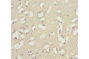Immunohistochemistry of paraffin-embedded human brain tissue using ABIN7173958 at dilution of 1:100 (INPP4A antibody  (AA 1-250))