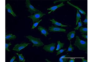 Immunofluorescence of monoclonal antibody to USP9X on HeLa cell. (USP9X antibody  (AA 1-90))