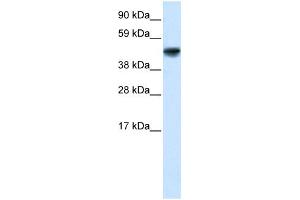 WB Suggested Anti-GAS7 Antibody Titration: 5. (GAS7 antibody  (N-Term))