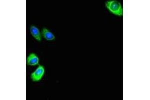 Immunofluorescent analysis of HepG2 cells using ABIN7144175 at dilution of 1:100 and Alexa Fluor 488-congugated AffiniPure Goat Anti-Rabbit IgG(H+L) (ASB1 antibody  (AA 1-300))