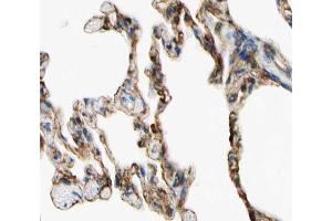 ABIN6266766 at 1/100 staining human lung tissue sections by IHC-P.