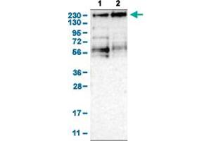 Western Blot analysis of (1) human cell line RT-4, and (2) human cell line U-251MG sp.