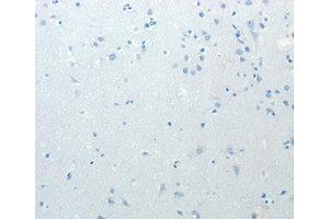 Immunohistochemistry (IHC) image for anti-Minichromosome Maintenance Deficient 4 (MCM4) antibody (ABIN1873665)