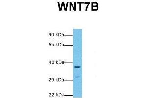 Western Blotting (WB) image for anti-Wingless-Type MMTV Integration Site Family, Member 7B (WNT7B) (Middle Region) antibody (ABIN2776732)