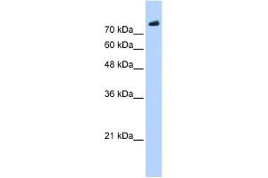 WB Suggested Anti-PHF20 Antibody Titration:  0. (PHF20 antibody  (C-Term))