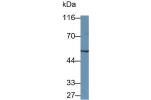 Detection of WARS in Mouse Pancreas lysate using Polyclonal Antibody to Tryptophanyl tRNA Synthetase (WARS) (WARS antibody  (AA 29-195))