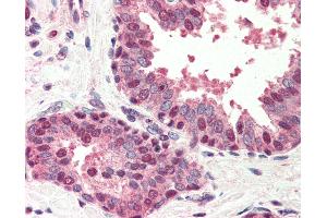 Anti-BIK antibody IHC of human prostate.