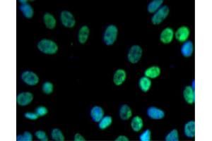 Immunofluorescent staining of SK-N-SH cells (Human neuroblastoma, ATCC HTB-11) (right). (PSIP1 antibody  (AA 85-188))