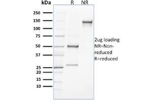 SDS-PAGE Analysis Purified CLEC9A Mouse Monoclonal Antibody (8F9). (CLEC9A antibody)