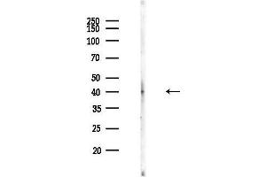 anti-Galactose Mutarotase (Aldose 1-Epimerase) (GALM) (C-Term) antibody