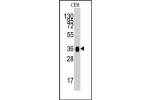 Image no. 1 for anti-Aldolase A, Fructose-Bisphosphate (ALDOA) (N-Term) antibody (ABIN357866) (ALDOA antibody  (N-Term))