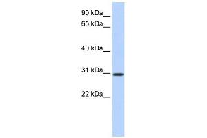 BCAS2 antibody used at 1 ug/ml to detect target protein. (BCAS2 antibody  (N-Term))