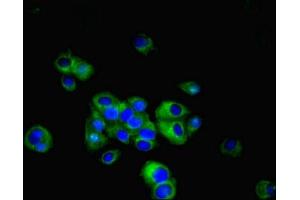 Immunofluorescent analysis of MCF-7 cells using ABIN7158090 at dilution of 1:100 and Alexa Fluor 488-congugated AffiniPure Goat Anti-Rabbit IgG(H+L) (LRRN3 antibody  (AA 201-500))