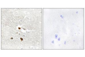 Immunohistochemistry (IHC) image for anti-Zinc Finger Protein 287 (ZNF287) (Internal Region) antibody (ABIN1849990)
