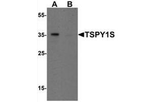 Western blot analysis of TSPY1S in A20 cell lysate with TSPY1S Antibody  at 1 μg/mL in (A) the absence and (B) the presence of blocking peptide (TSPY1 antibody  (C-Term, Isoform 1))