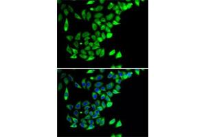 Immunofluorescence analysis of A-549 cells using PTGES2 antibody (ABIN6129085, ABIN6146404, ABIN6146406 and ABIN6222952). (PTGES2 antibody  (AA 88-377))