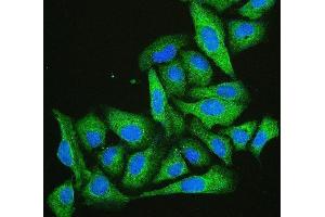 IF analysis of Cofilin-2 using anti-Cofilin-2 antibody (ABIN7602747). (Cofilin 2 antibody  (C-Term))