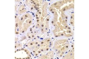 Immunohistochemistry of paraffin-embedded human kidney using PRDM14 antibody at dilution of 1:100 (x400 lens). (PRDM14 antibody)